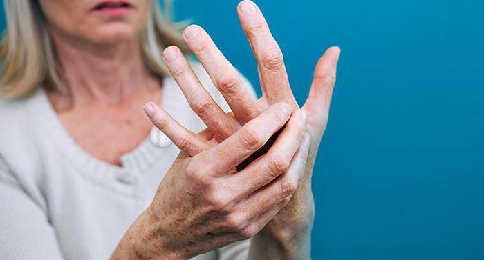 Romatoid artrit teşhisi nasıl konulur, belirtileri nelerdir?