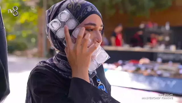 MasterChef'te yüzü yanan Beyza'dan haber var